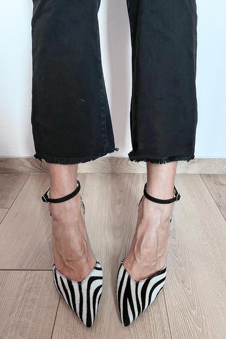 Allison | Zebra Print Pumps With Ankle Strap